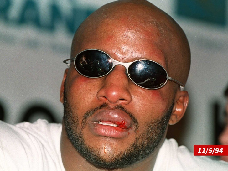 Michael Moorer memakai bibir yang diperbesar