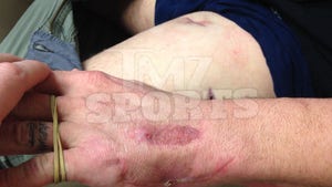 UFC Star Joe Riggs -- My Gunshot Wound Healed ... Check Out My New Scars