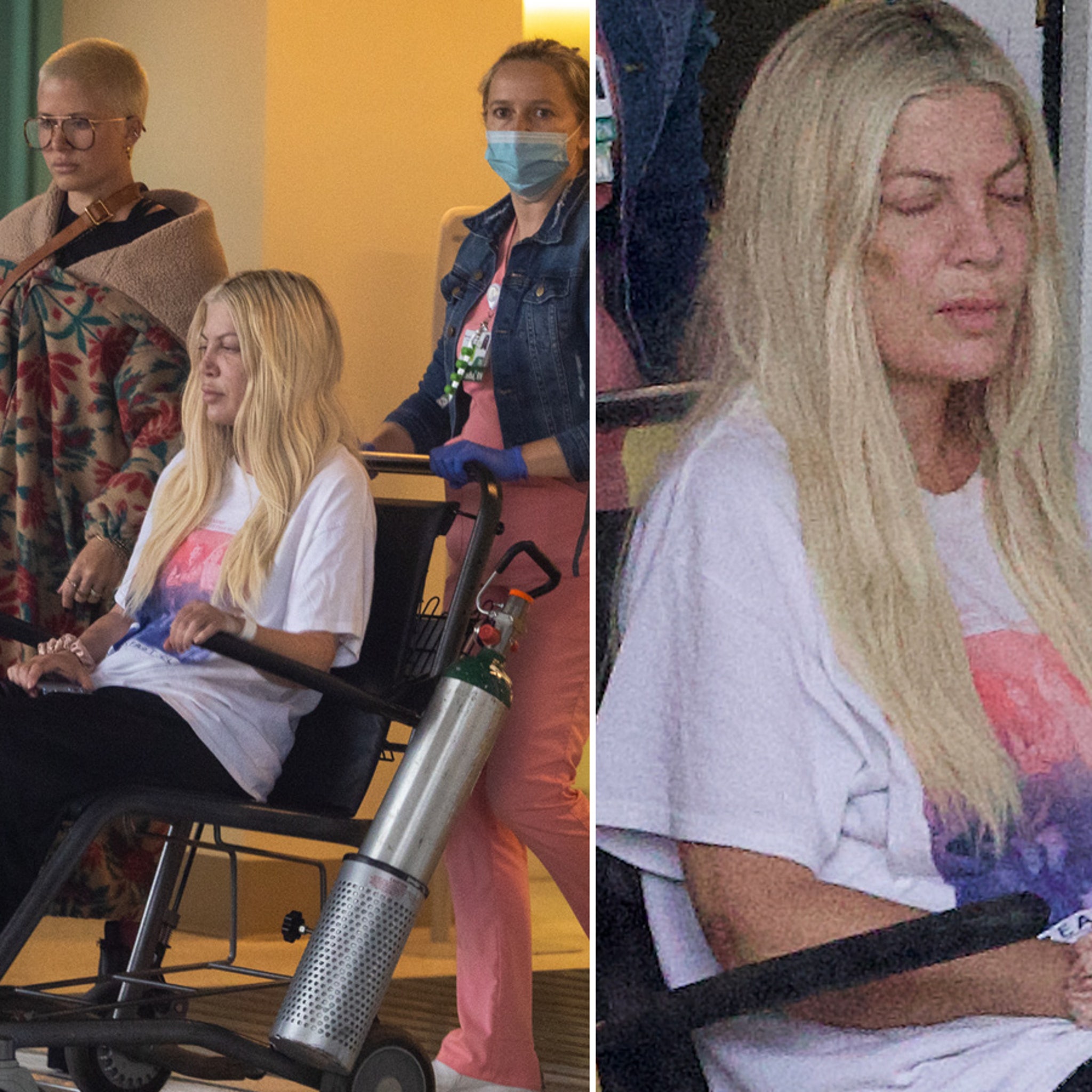 Tori Spelling Face Before And After Tori Spelling Face Before And After