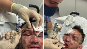 Michael Chandler Gets Face Fixed After Epic Gaethje Fight, 22 Stitches