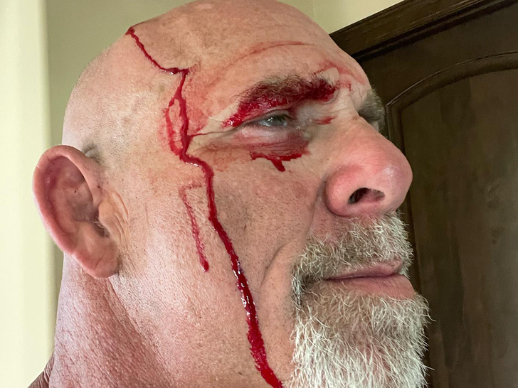 WWE star Goldberg suffers a head injury after tractor accident