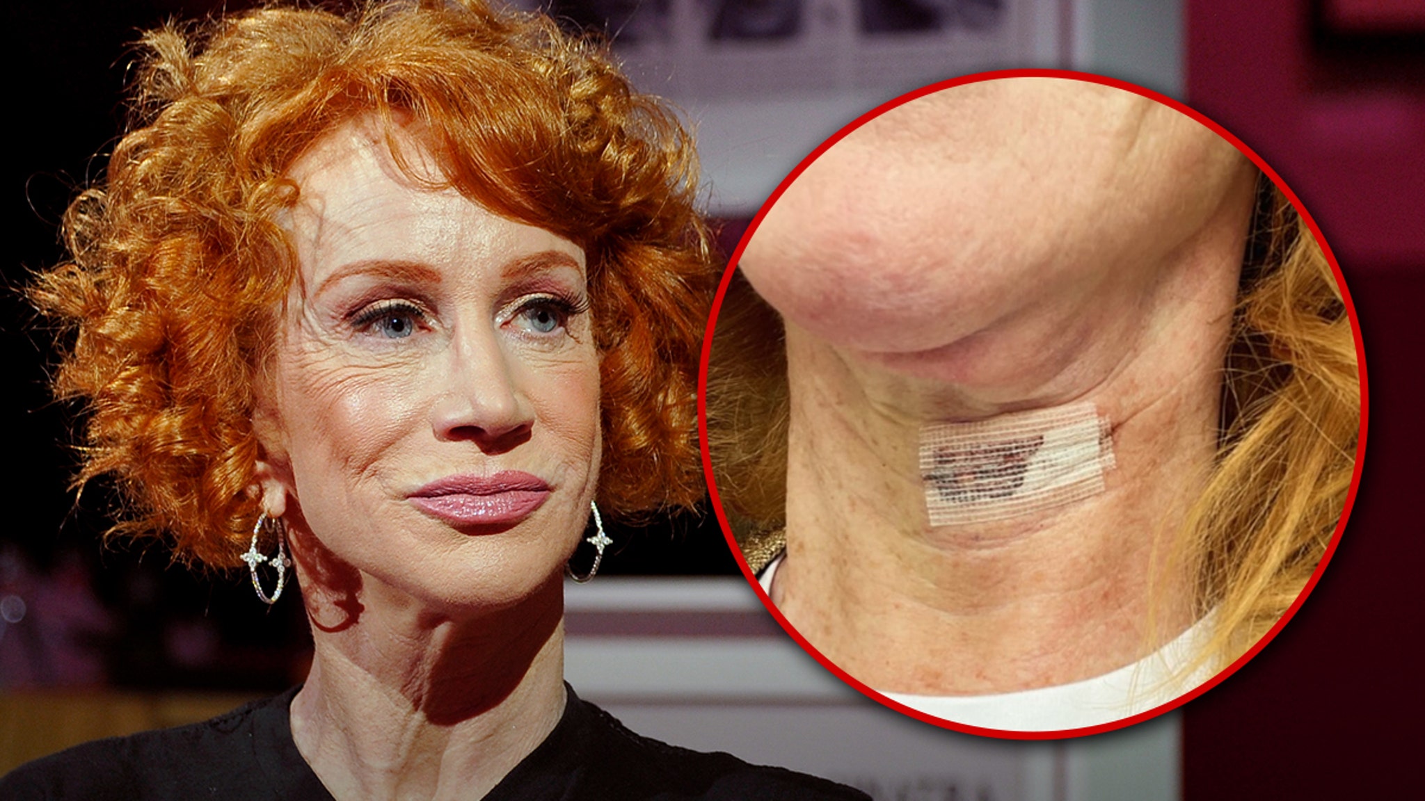 Kathy Griffin Shares IG Pic After Second Vocal Cord Surgery