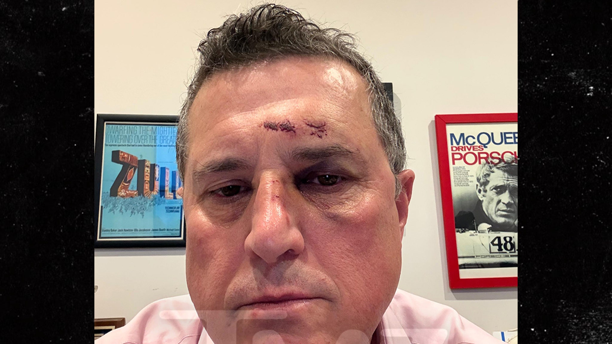 ‘Reacher’ Star Alan Ritchson’s Fight Opponent Shows Huge Shiner in New Pics