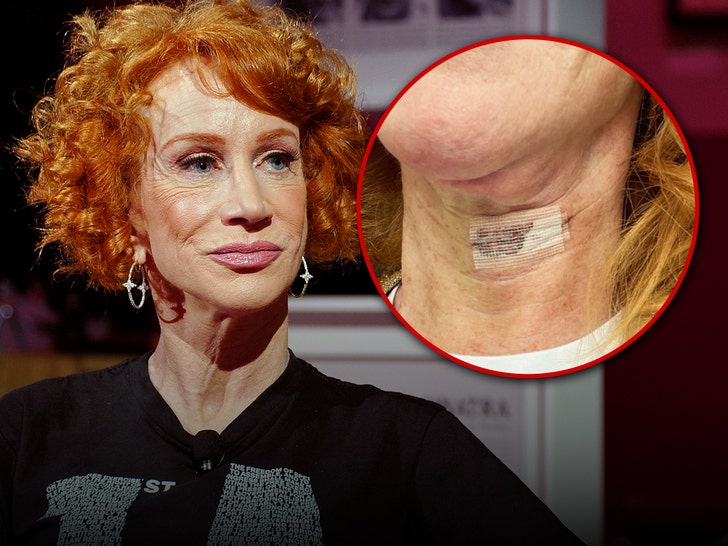 kathy griffin vocal cord