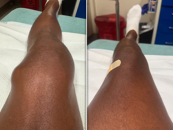 anthony anderson knee split sub instagram 3