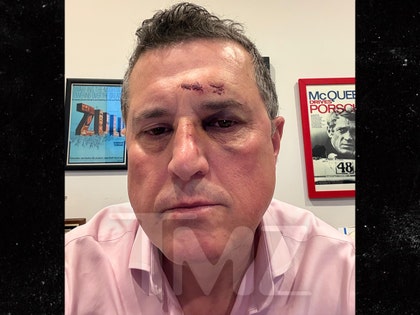 ronnie taylor injuries tmz handout 3