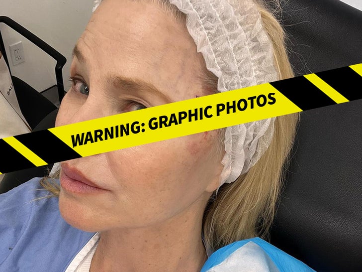 Christie Brinkley Skin Cancer Photos