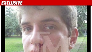 '16 & Pregnant' Baby Daddy -- The Bloodied Face Pic