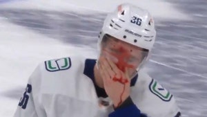 NHL's Nils Hoglander Takes Slapshot To Face, Blood Everywhere!