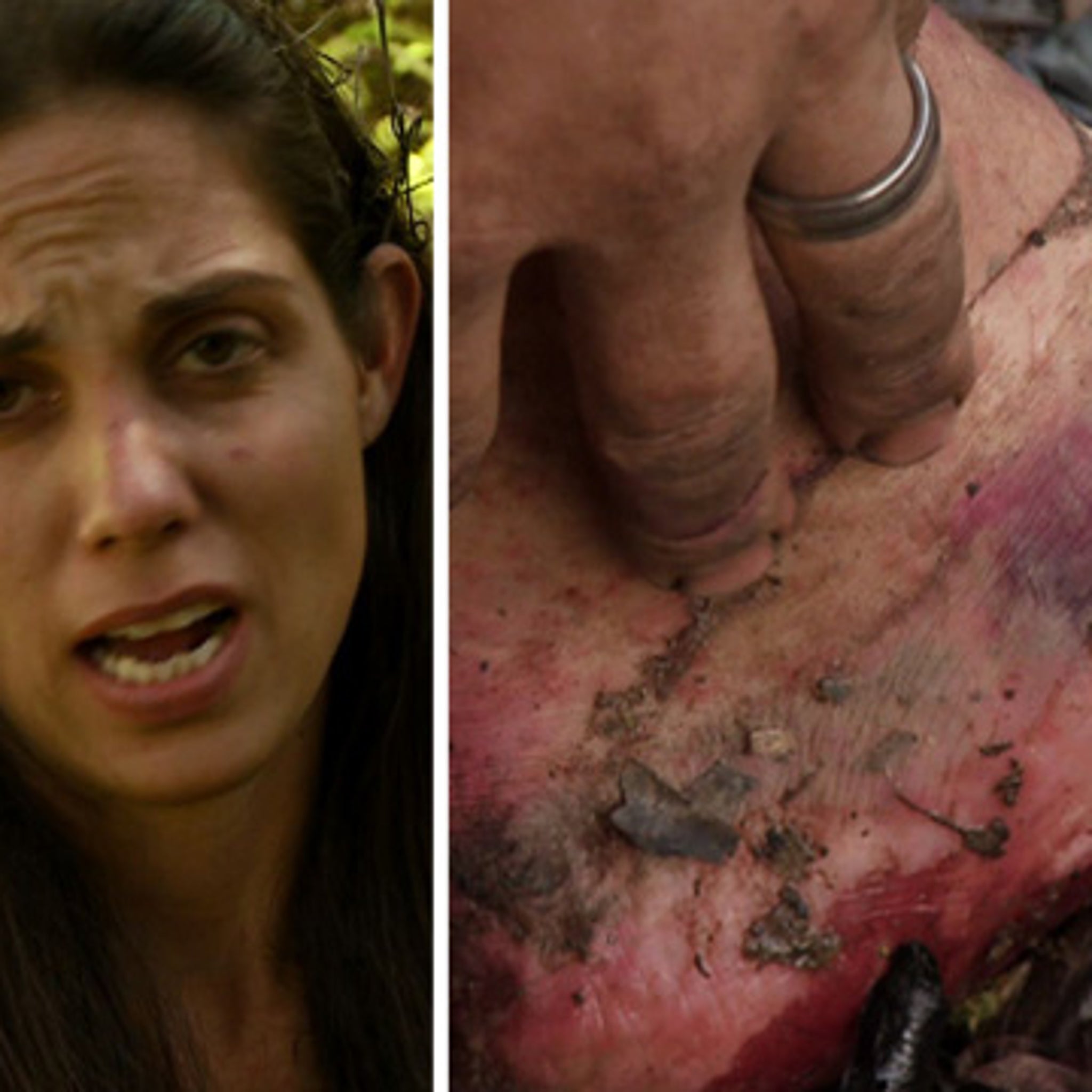 bugs in pussy) Naked & Afraid' Contestant -- Amazon Bugs Are Eating My Vajayjay!