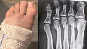 Darby Allin foot xray