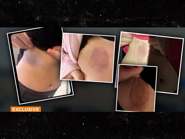 3 teens accused of assault dodgeball game 2