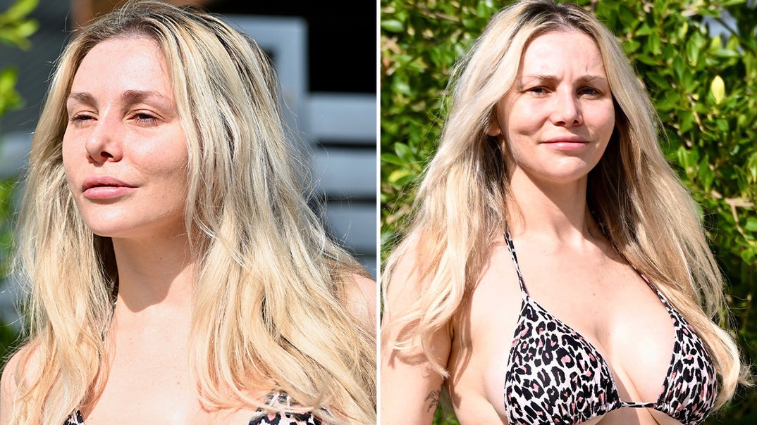 1022-Courtney-Stodden-Nose-Job-PRIMARY