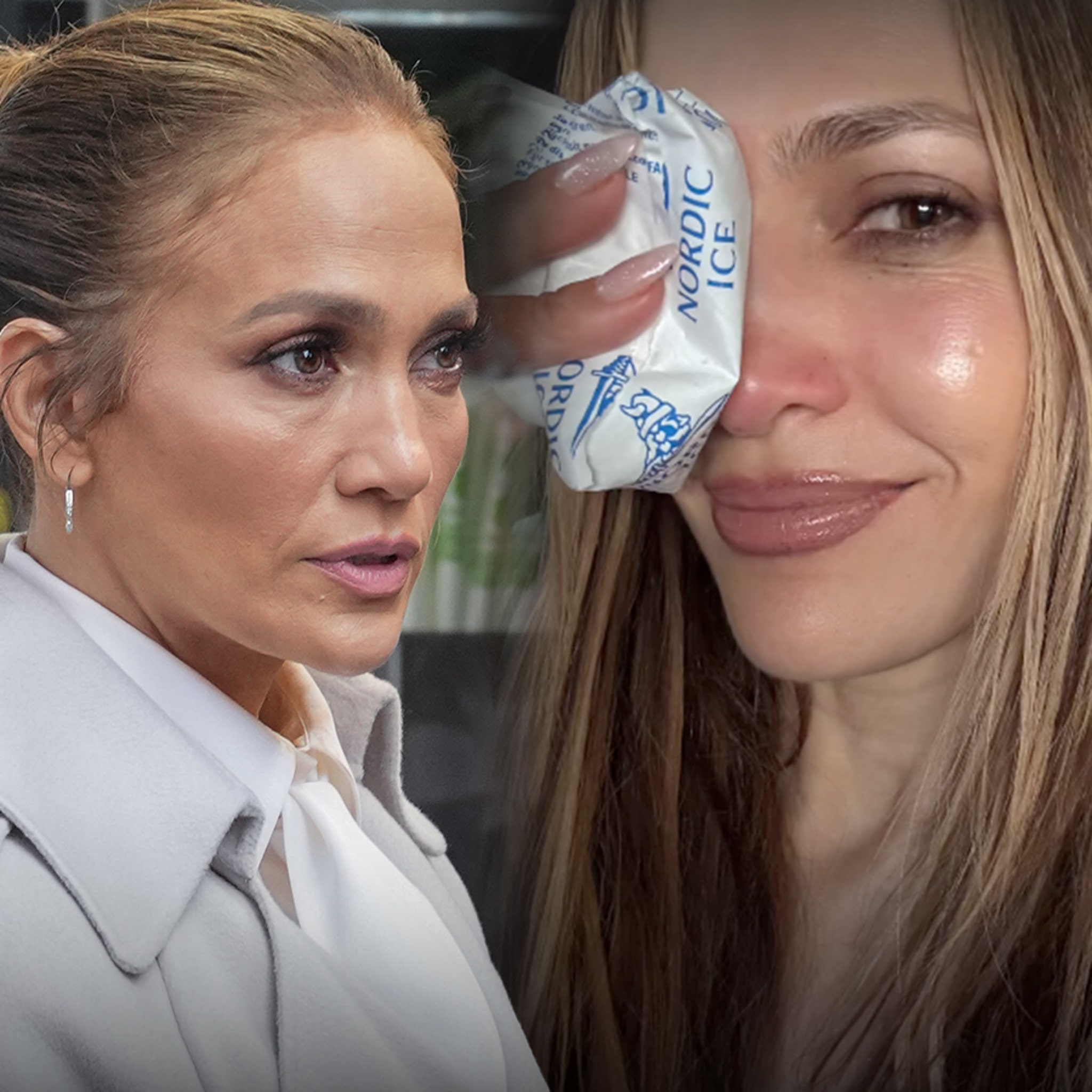 Jennifer Lopez Gets Stitches After Injuring Herself at AMAs Rehearsals