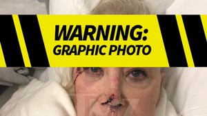 0209-sally-kirkland-injury-photo-tmz-primary-launch-01