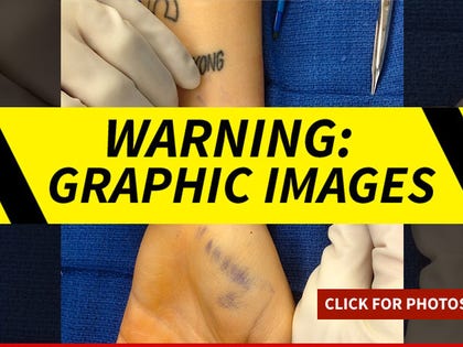 1213-miley-cyrus-wound-warning-INSTAGRAM-01