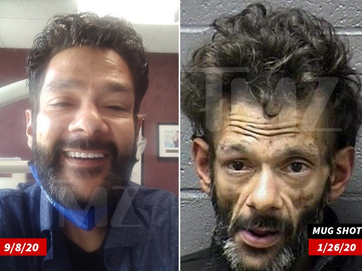'Mighty Ducks' Star Shaun Weiss Completes Teeth Reconstruction