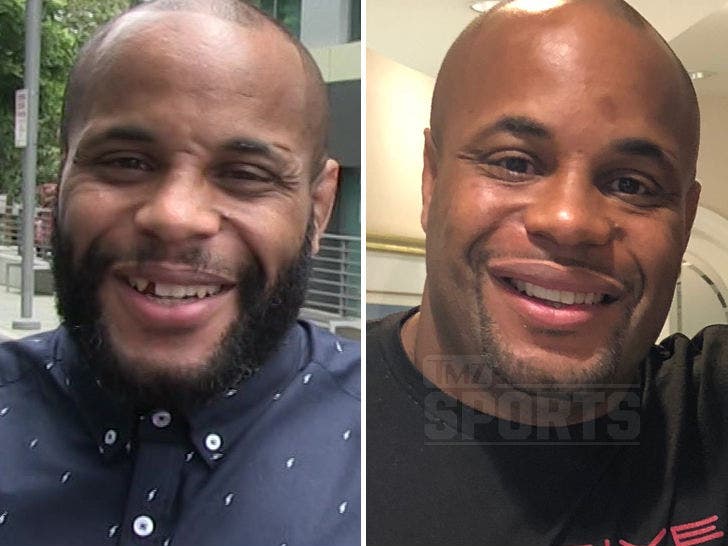 Daniel Cormier Fixes Infamous Gap In His Teeth