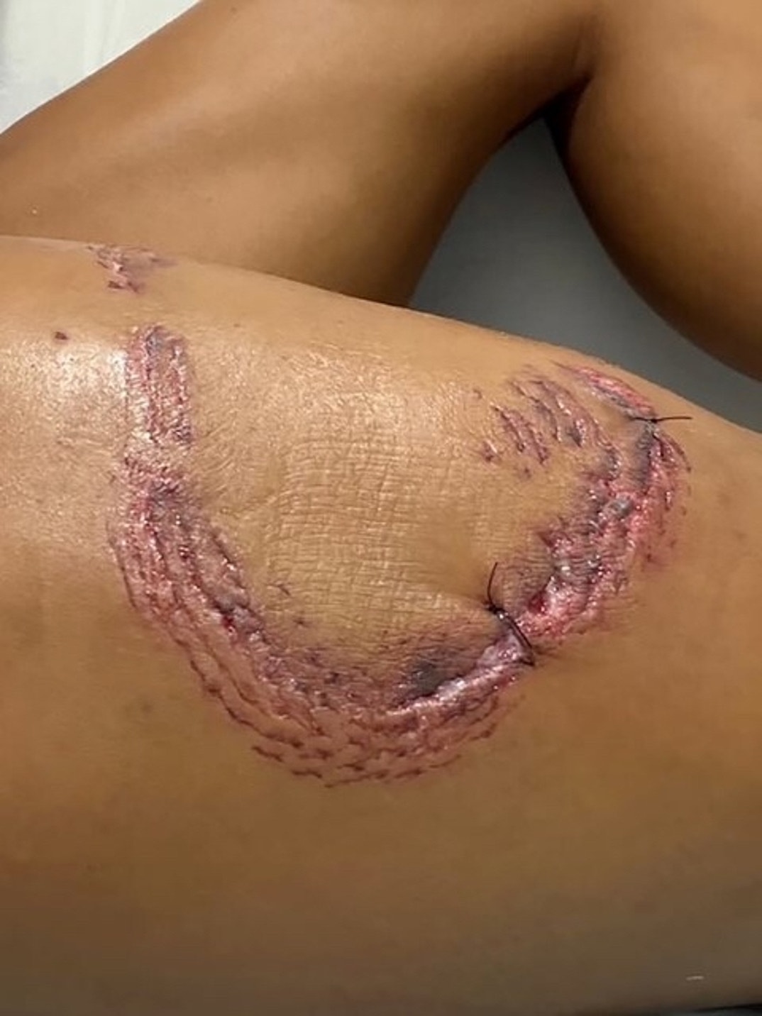 Lawyer Tayane Dalazen Shark Attack 3