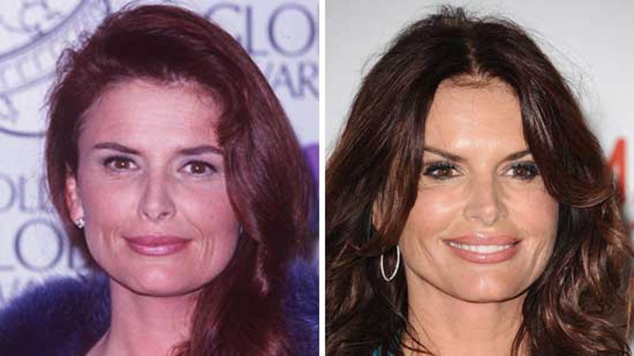 Roma downey plastic surgery