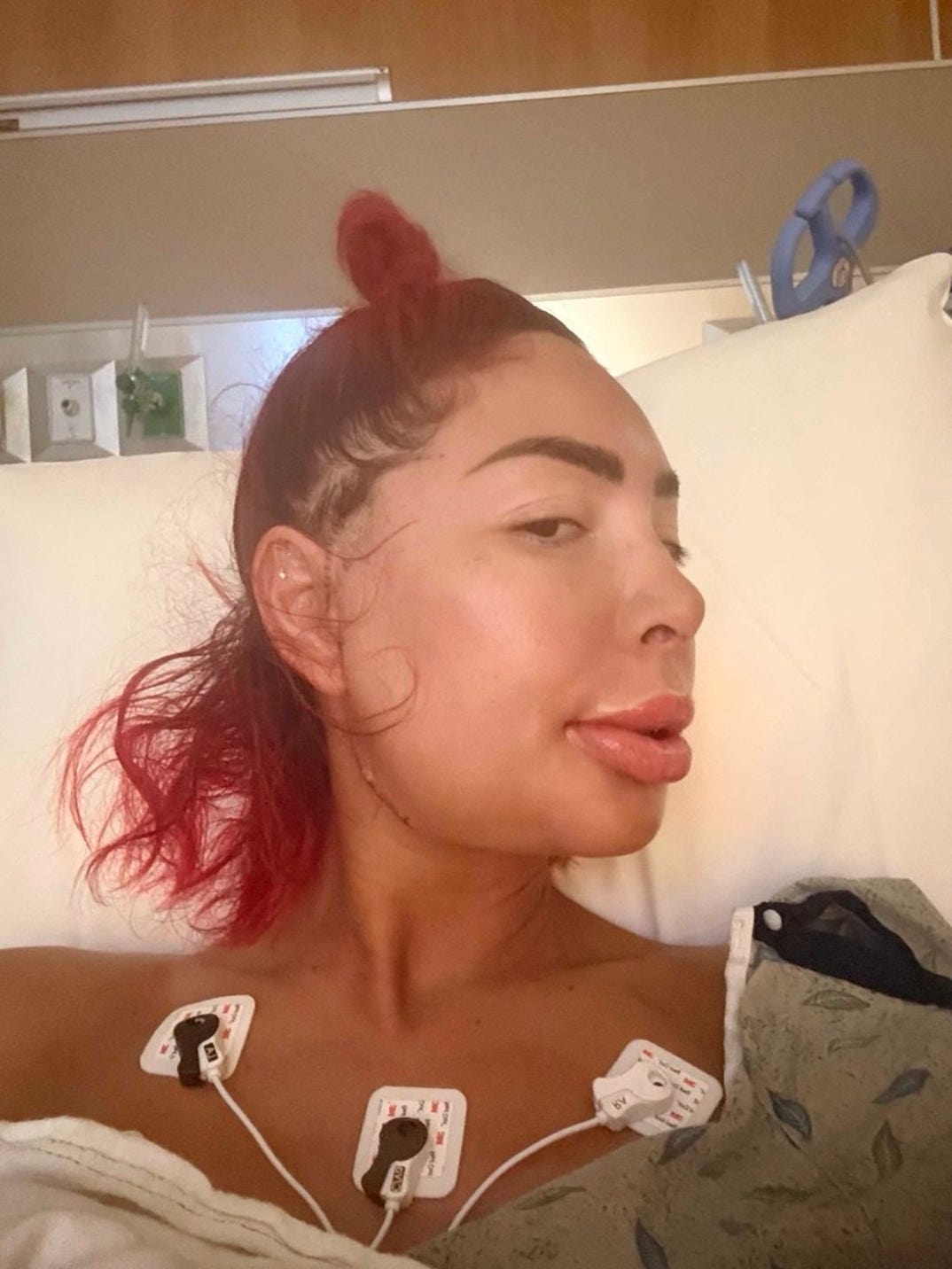 Farrah Abraham Post Op Photos 6