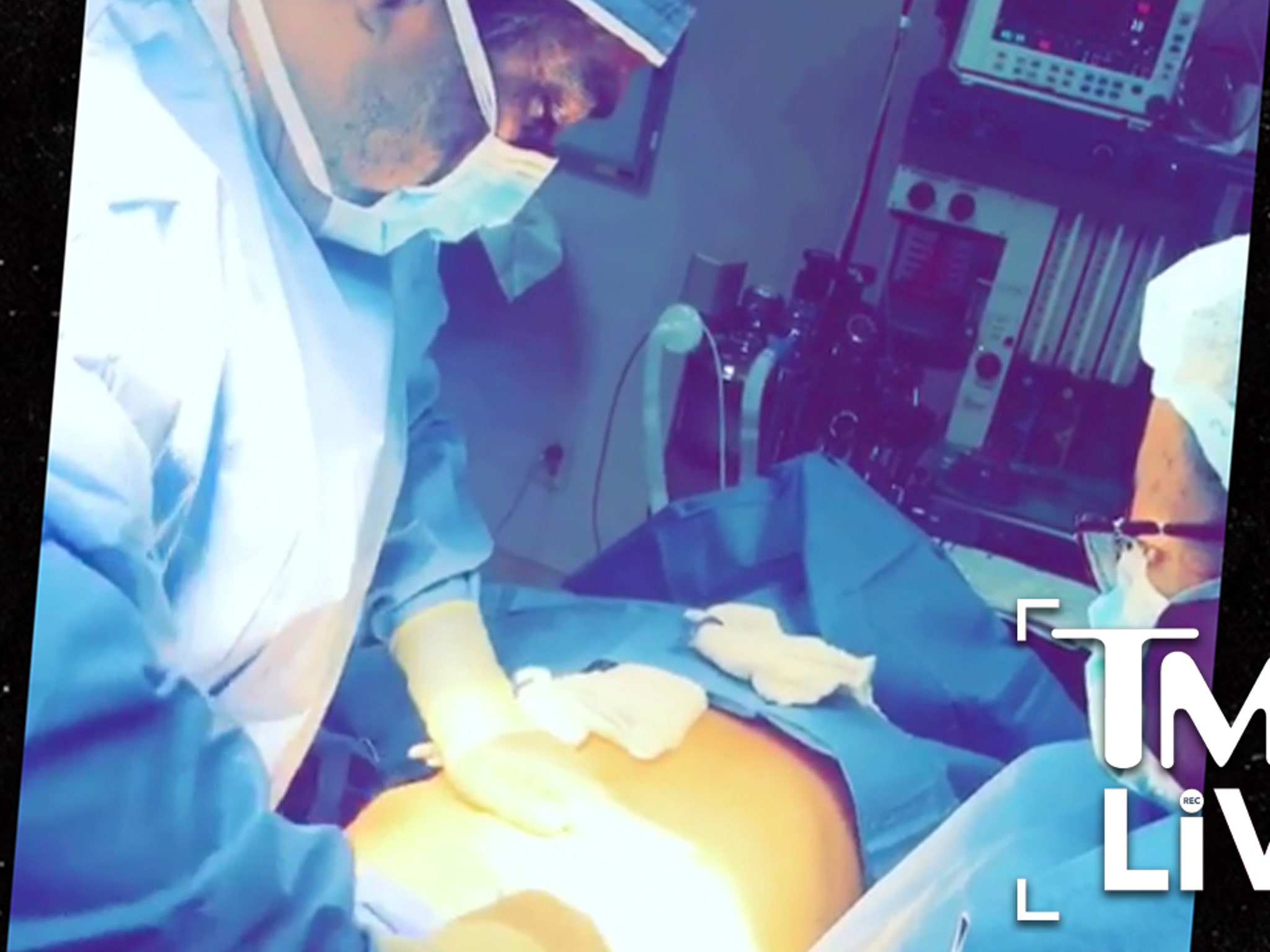 Celeb Plastic Surgery Nightmare I TMZ LIVE