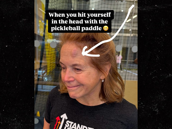 Katie Couric instagram story pickleball hit injury