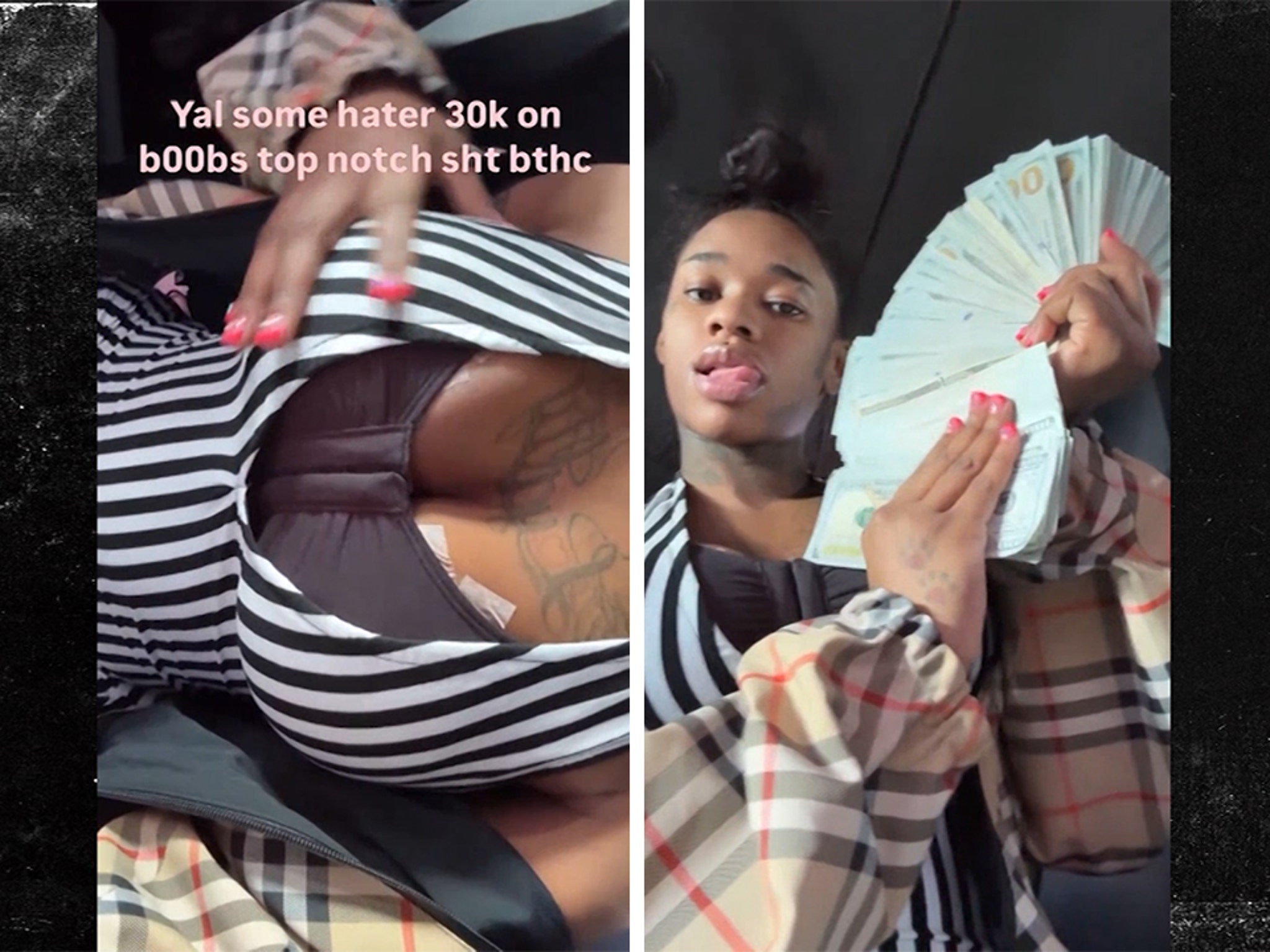 Sexyy Red Shares First Look at $30K Boob Job
