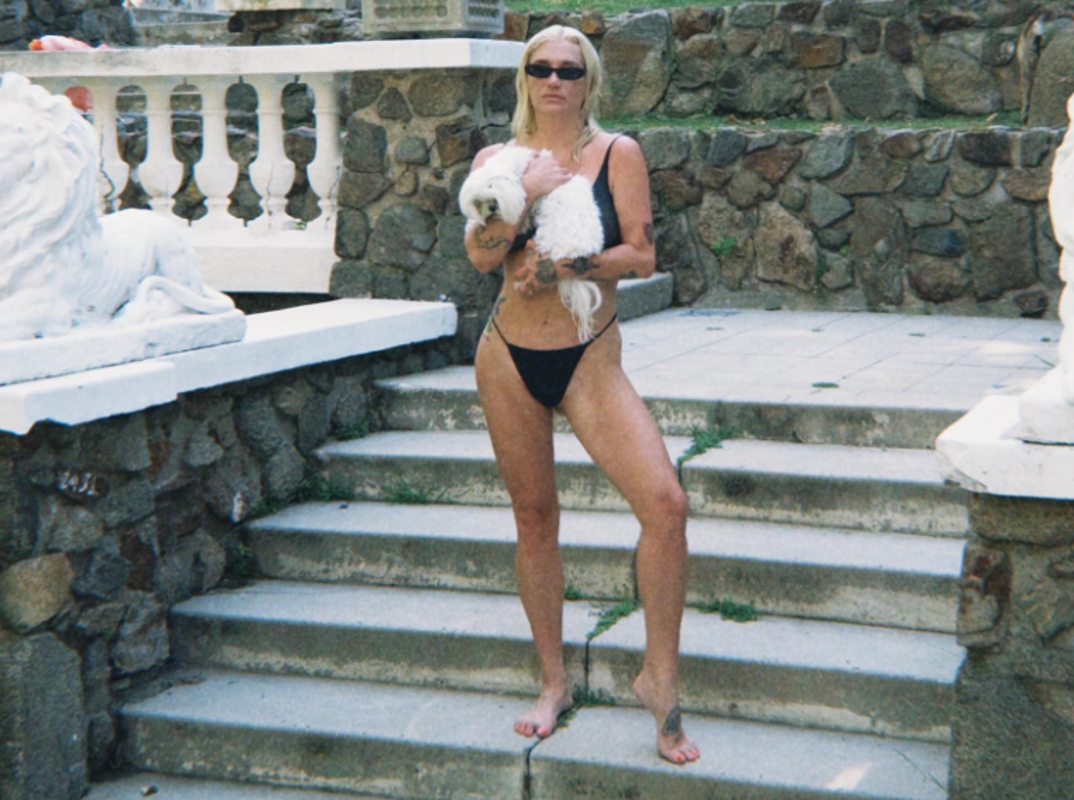 KESHA Hot Shots Photos 0