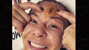 Cris Cyborg Shows Bloody Post-Fight Gash, 'I Could See My Skull!'