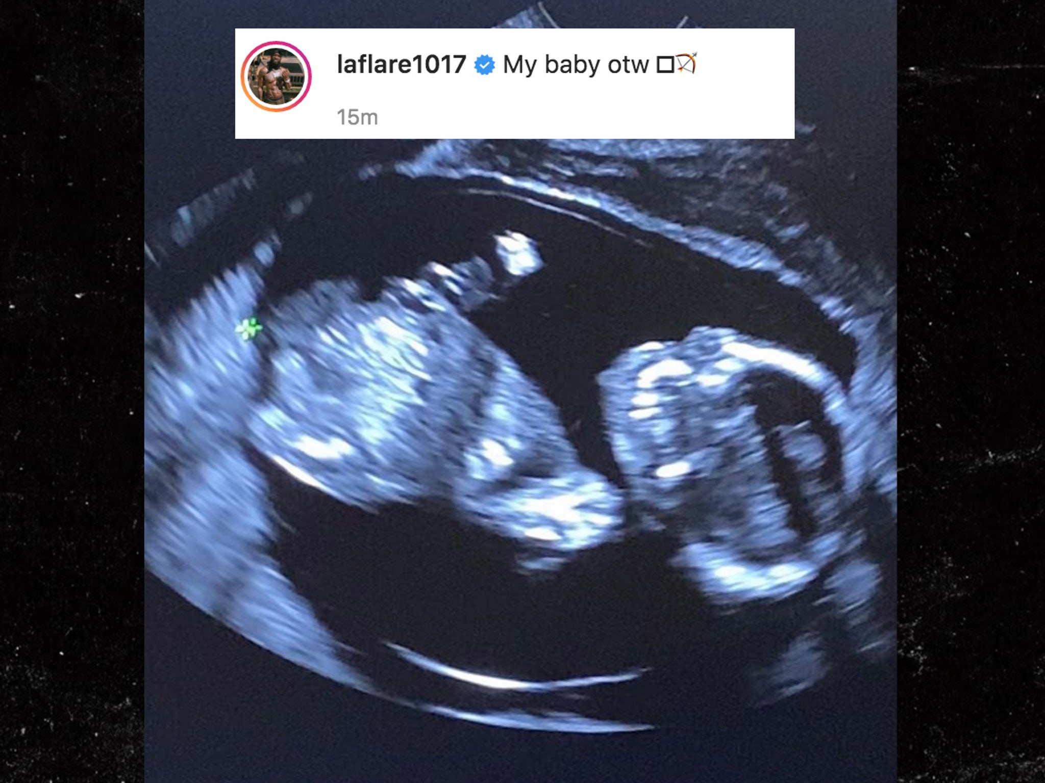Gucci Mane Shares Baby Sonogram Photos