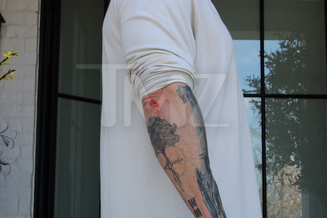 Alan Ritchson Injury Photos 0