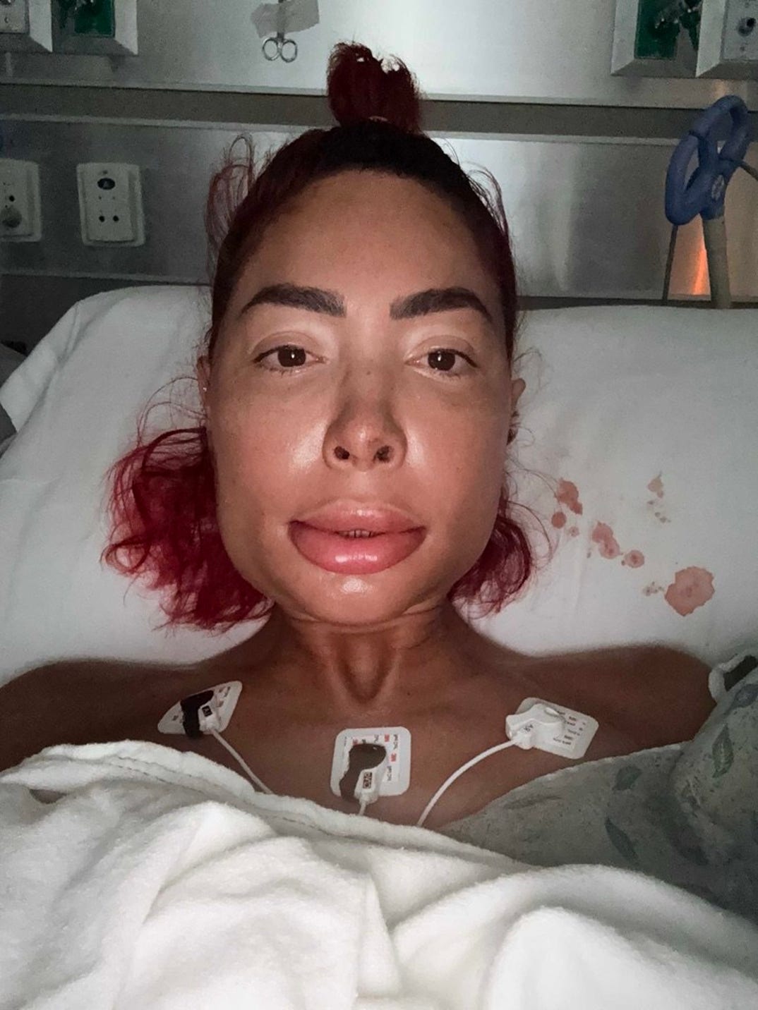 Farrah Abraham Post Op Photos 5
