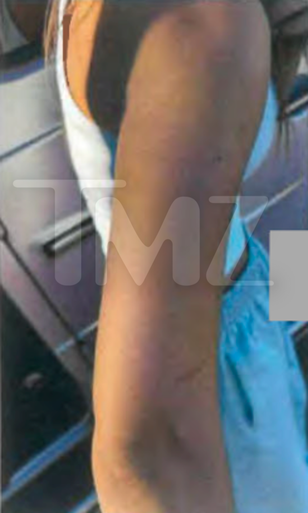 Maria Lafuente Injuries 3