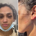 Miles Bridges' Wife Posts Injury Photos After Alleged Attack