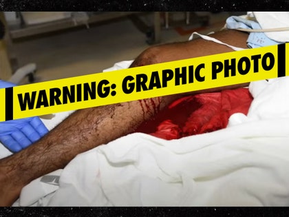 lapd body cam injury launch