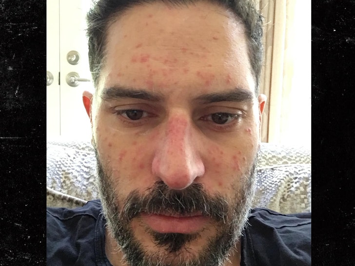 JOE MANGANIELLO hospital pics