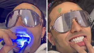 Lil Pump Gets $25,000 Mouth Makeover with New Teeth
