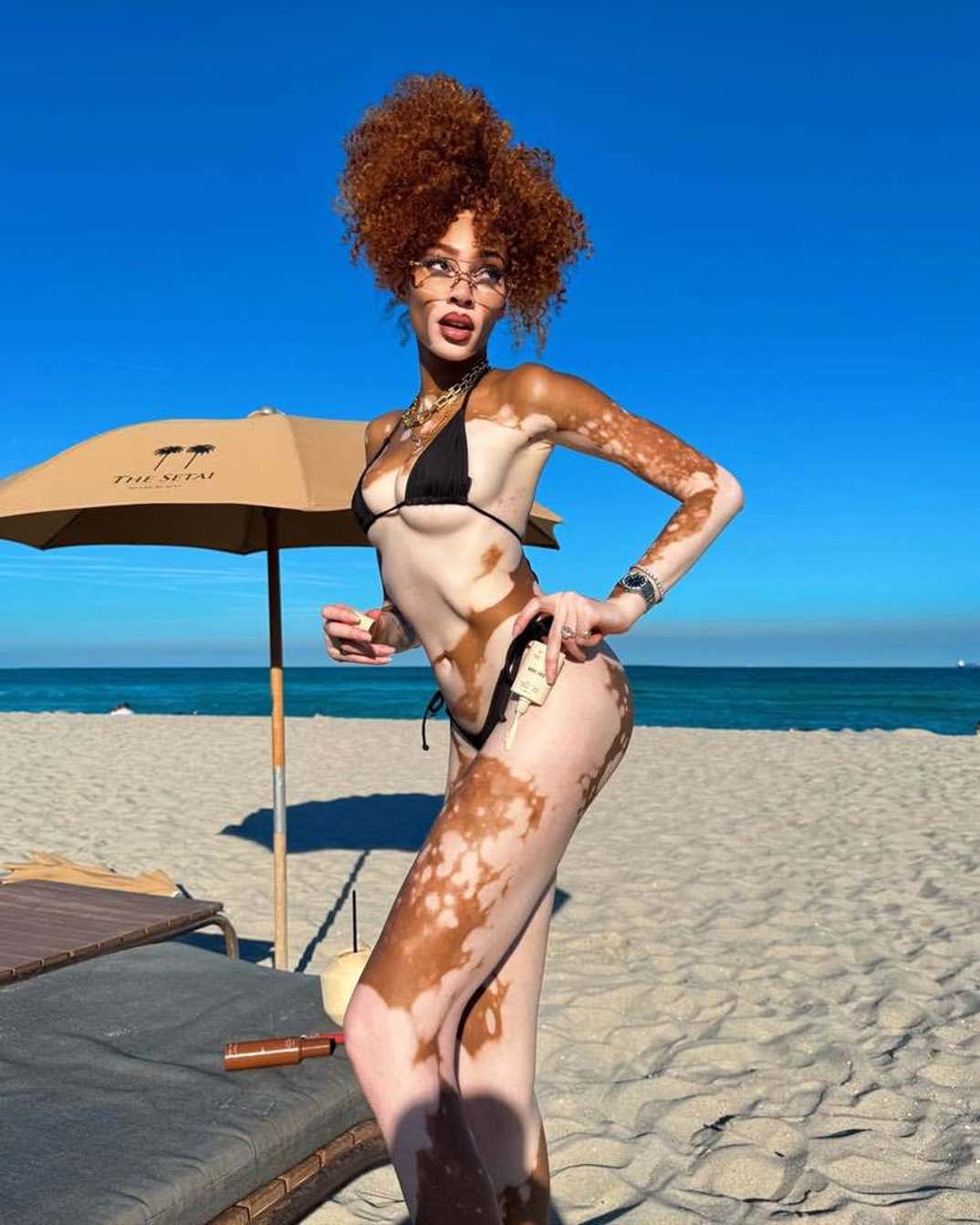 Winnie Harlow