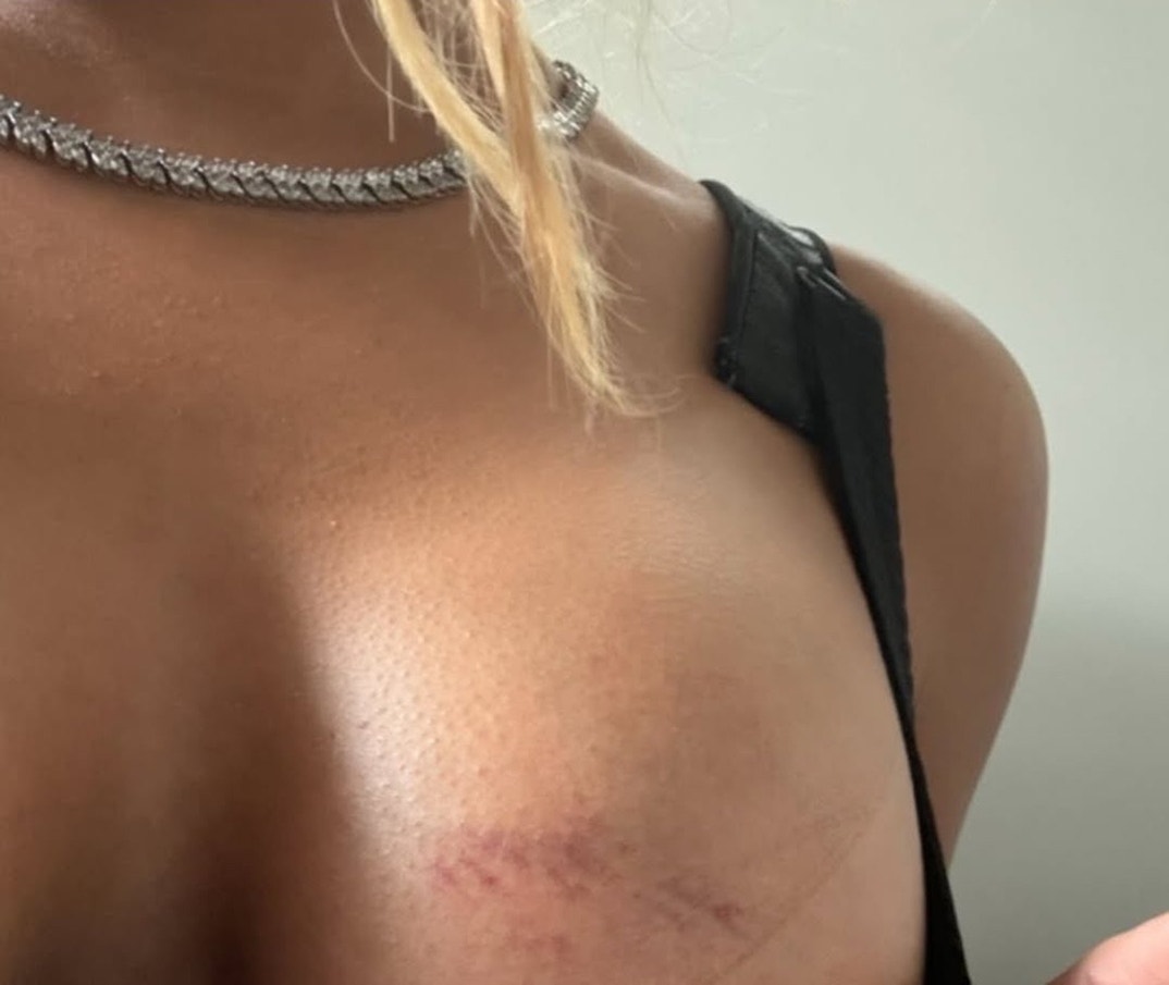 Dacoda Nichole Abuse 7