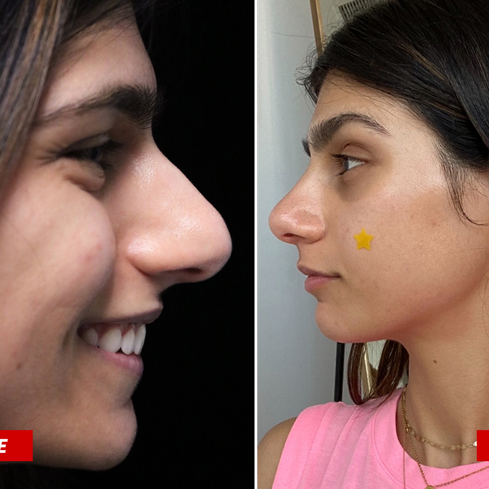 2048px x 2048px - Mia Khalifa Gets $15,000 Nose Job, See The Results