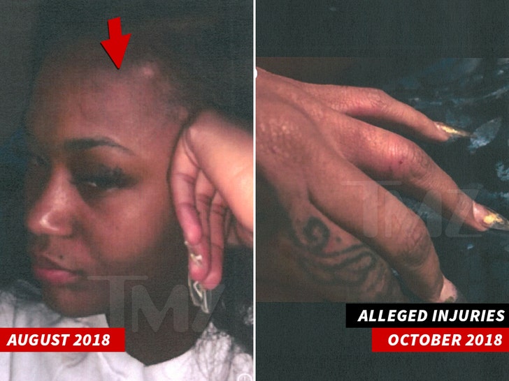 1212 Lira Galore head finger injury tmz wm 2