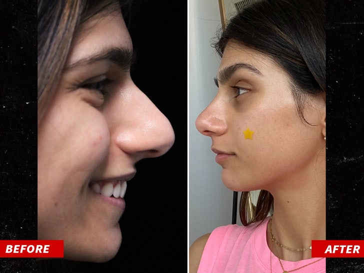 Best Before And After Porn - Mia Khalifa Gets $15,000 Nose Job, See The Results