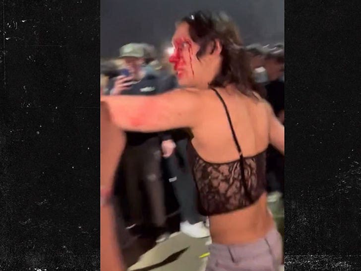 Transgender Woman Beaten at Kanye West Show Says Attack Was Transphobic