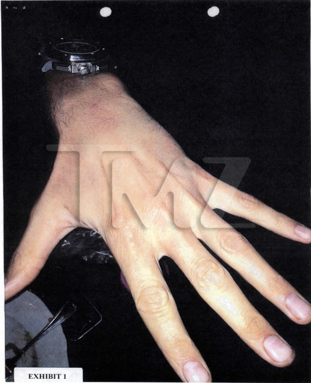 gabriel_aubry_fight_injuries_02
