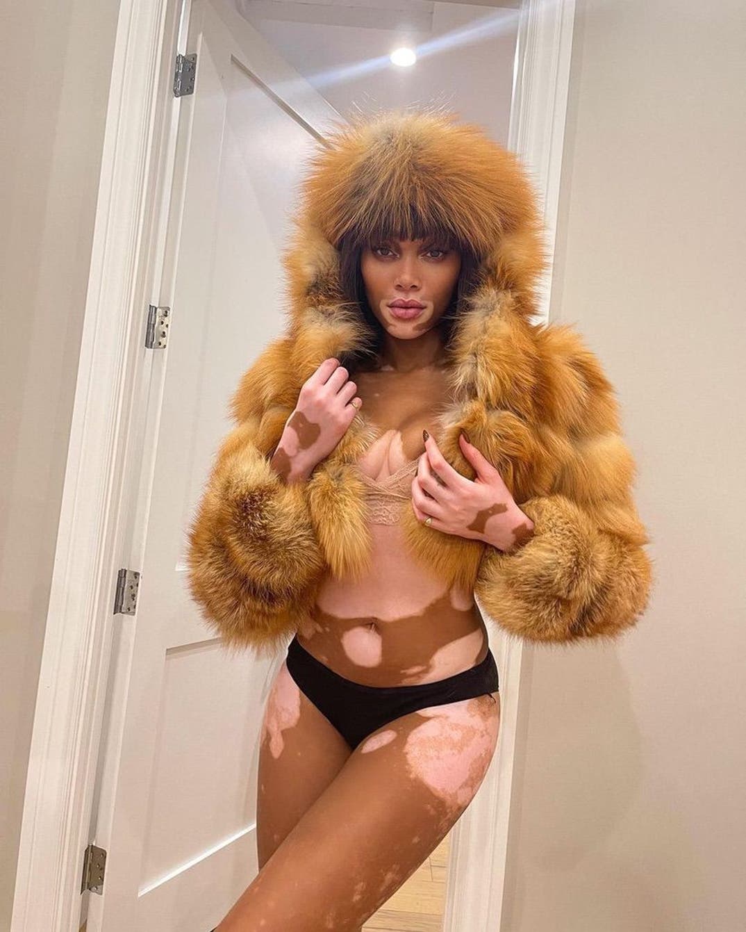 0726 Winnie Harlow Hot Shots 6