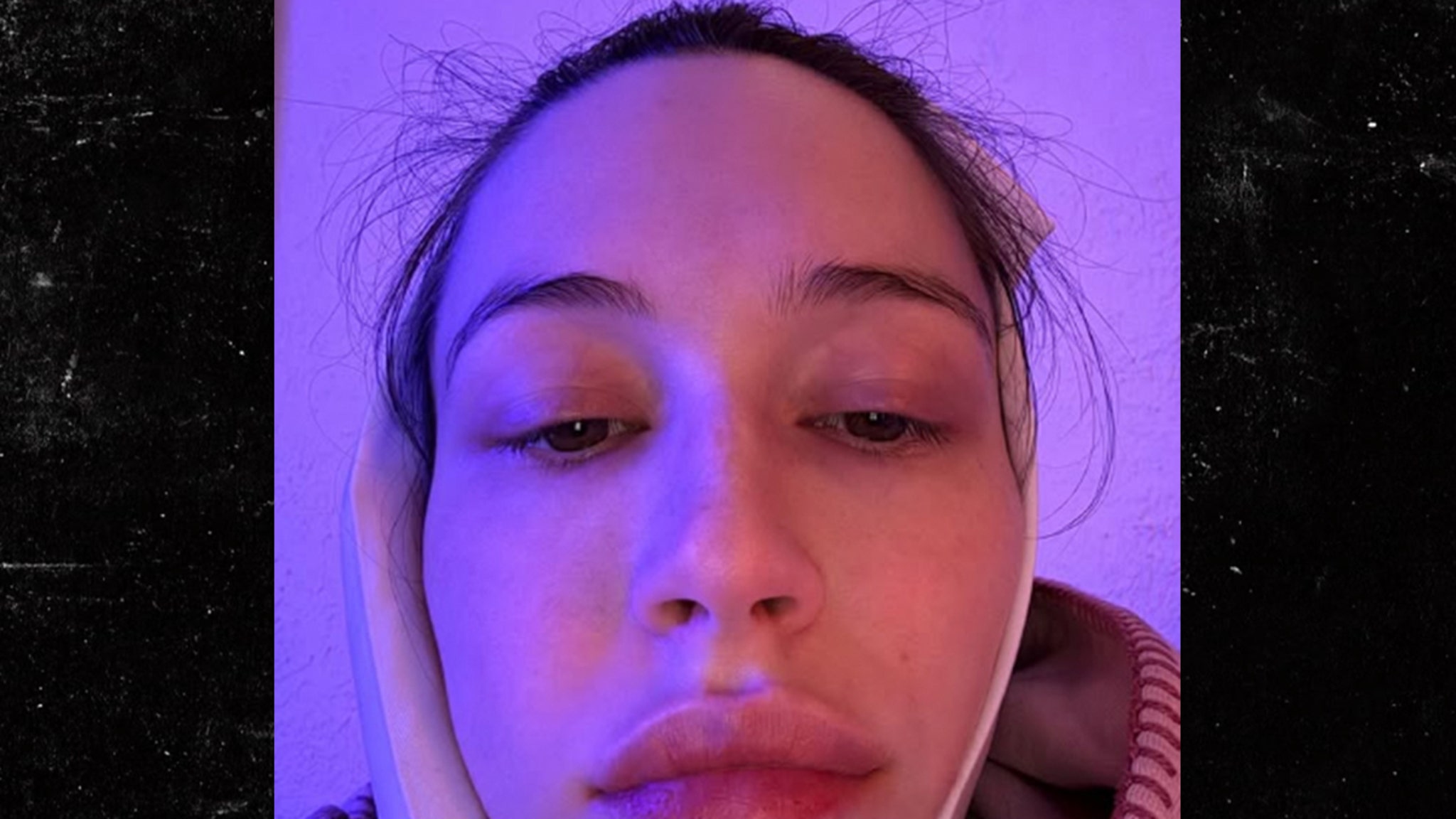 Elsie Hewitt werd een dag na de bevalling geopereerd om de verstandskies te laten verwijderen