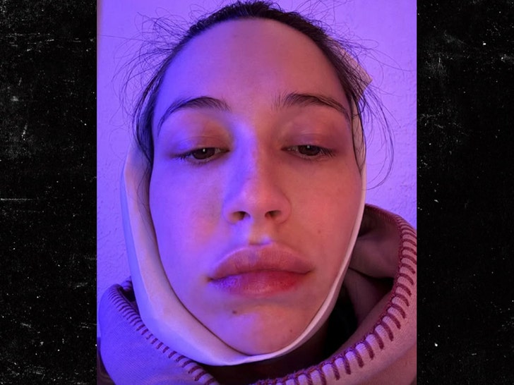 elsie hewitt gets wisdom teeth removed