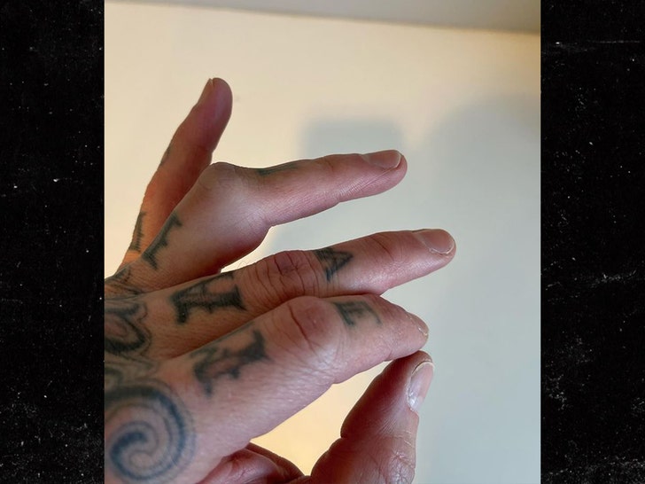 travis barker hand injury insta