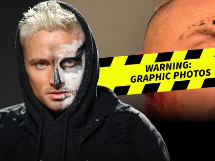Darby Allin graphic injuries getty insta 1